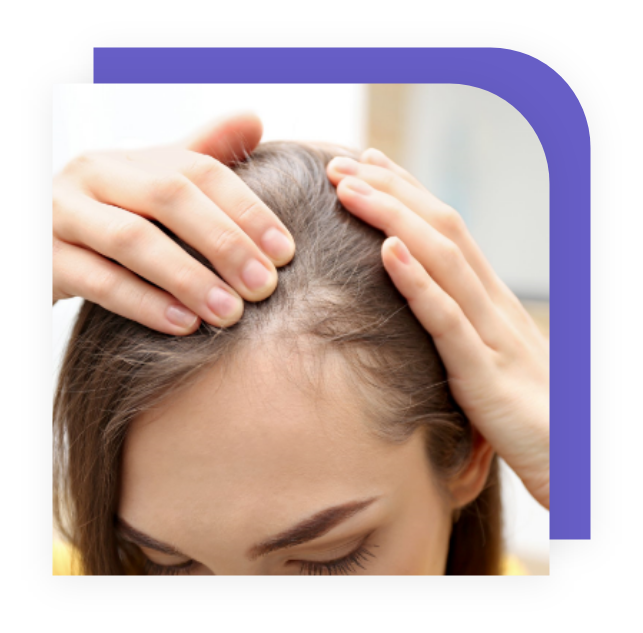 Hair Loss Treatment in Fairmont, MN | Medical Spa